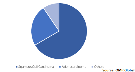  Global Cervical Cancer Treatment Market Share by Application 