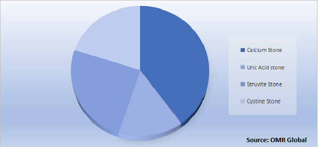 Global Kidney Stones Diagnosis and Treatment Market Share by Type