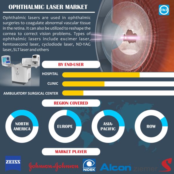 Ophthalmic Lasers Market Report
